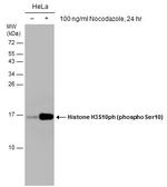 Phospho-Histone H3 (Ser10) Antibody in Western Blot (WB)