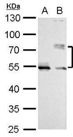 Cdc25C Antibody in Western Blot (WB)