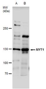MYT1 Antibody in Western Blot (WB)