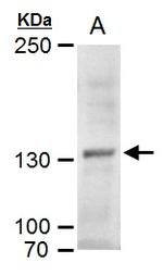MYT1 Antibody in Western Blot (WB)
