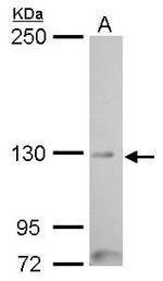 MYT1 Antibody in Western Blot (WB)