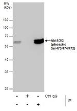 Phospho-AKT1 (Ser473) Antibody in Immunoprecipitation (IP)
