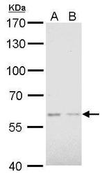 AKT2 Polyclonal Antibody