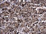 AKT2 Polyclonal Antibody