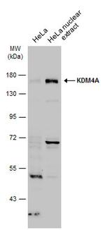 JMJD2A Polyclonal Antibody