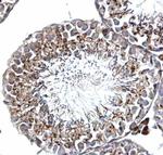 SLUG Polyclonal Antibody