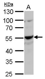 NAMPT Antibody in Western Blot (WB)