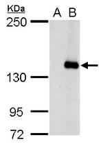 JARID2 Polyclonal Antibody