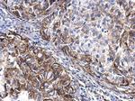 TGF alpha Polyclonal Antibody