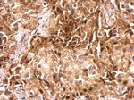 CDR2 Antibody in Immunohistochemistry (Paraffin) (IHC (P))