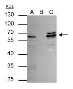 CDR2 Antibody in Immunoprecipitation (IP)