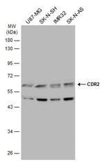 CDR2 Antibody in Western Blot (WB)
