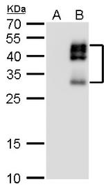 DLX2 Polyclonal Antibody