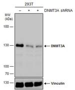 DNMT3A Polyclonal Antibody