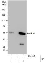 IRF4 Antibody in Immunoprecipitation (IP)