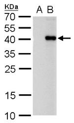 PITX2 Polyclonal Antibody