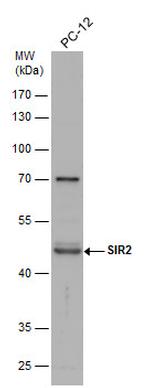 SIRT2 Polyclonal Antibody