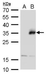 Neurogenin 1 Polyclonal Antibody