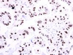 TCF2 Polyclonal Antibody