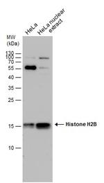 Histone H2B Antibody in Western Blot (WB)