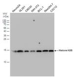 Histone H2B Antibody in Western Blot (WB)
