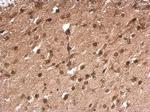 TLX3 Polyclonal Antibody