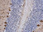 ICMT Polyclonal Antibody