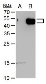 E2F5 Polyclonal Antibody