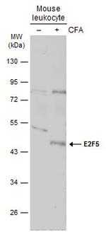 E2F5 Antibody in Western Blot (WB)