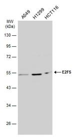 E2F5 Antibody in Western Blot (WB)