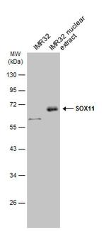 SOX11 Polyclonal Antibody