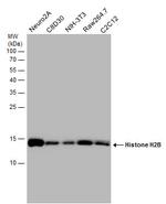 Histone H2B Antibody in Western Blot (WB)