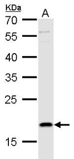 TSLP Polyclonal Antibody