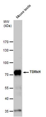 TDRKH Polyclonal Antibody