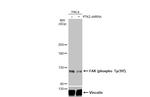 Phospho-FAK (Tyr397) Antibody in Western Blot (WB)