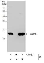 SEC61B Antibody in Immunoprecipitation (IP)