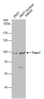 TOP1 Polyclonal Antibody