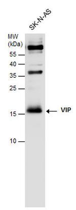 VIP Antibody in Western Blot (WB)