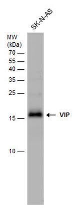VIP Antibody in Western Blot (WB)