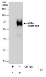 alpha Internexin Antibody in Immunoprecipitation (IP)