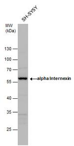 alpha Internexin Antibody in Western Blot (WB)