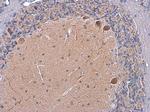 SSTR3 Antibody in Immunohistochemistry (Paraffin) (IHC (P))