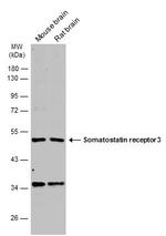 SSTR3 Antibody in Western Blot (WB)