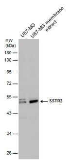 SSTR3 Antibody in Western Blot (WB)