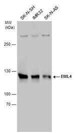 EML4 Antibody in Western Blot (WB)