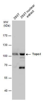 TOP1 Polyclonal Antibody