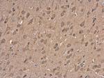 NMDAR2B Antibody in Immunohistochemistry (Paraffin) (IHC (P))