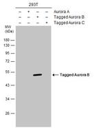 Aurora B Polyclonal Antibody