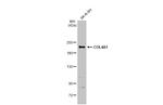 COL4A1 Antibody in Western Blot (WB)