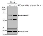 Aurora B Polyclonal Antibody